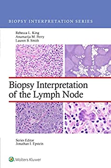 Biopsy Interpretation of the Lymph Nodes (Biopsy Interpretation Series) (EPUB)