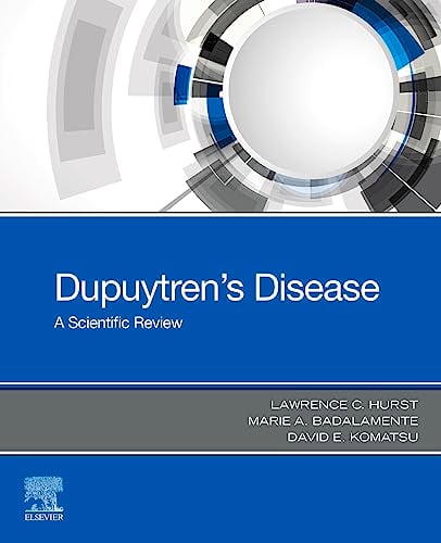Dupuytren's Disease: A Scientific Review (Original PDF from Publisher)