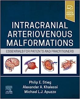 Intracranial Arteriovenous Malformations: Essentials for Patients and Practitioners (ePub+Converted PDF)