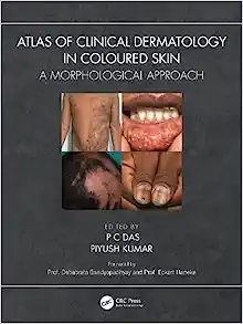 Atlas of Clinical Dermatology in Coloured Skin: A Morphological Approach (Original PDF from Publisher)