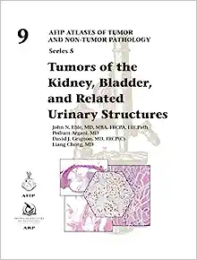 Tumors of the Kidney, Bladder, and Related Urinaray Structures (AFIP Atlases of Tumor and Non-tumor Pathology, Series 5, Volume 9) (Original PDF from Publisher)