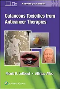 Cutaneous Reactions from Anti-Cancer Therapies (EPUB)