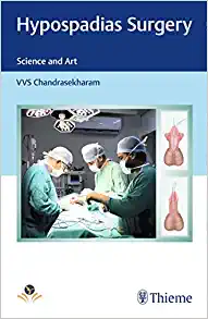 Hypospadias Surgery: Science and Art (Original PDF from Publisher)