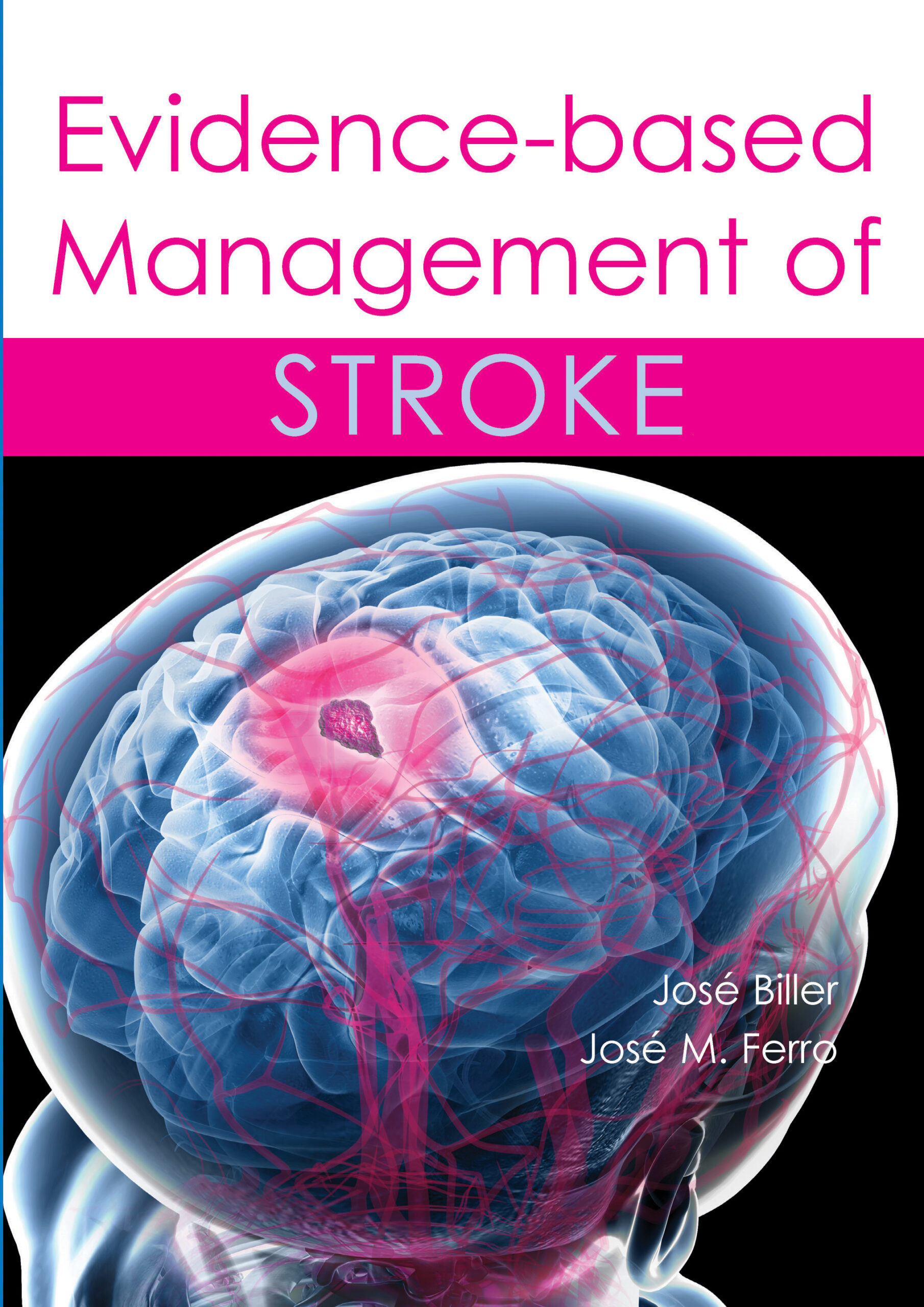 Evidence-based Management of Stroke (EPUB)