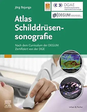 Atlas Schilddrüsensonografie (German Edition) (True PDF from Publisher)