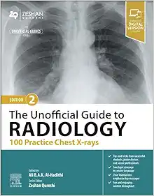 The Unofficial Guide to Radiology: 100 Practice Chest X-rays, 2nd Edition (True PDF from Publisher)