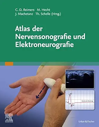 Atlas der Nervensonografie und Elektroneurografie (German Edition) (True PDF from Publisher)
