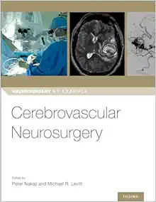 Cerebrovascular Neurosurgery (Neurosurgery by Example) (Original PDF from Publisher)
