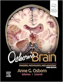 Osborn's Brain, 3rd edition (True PDF from Publisher)