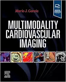 Multimodality Cardiovascular Imaging (EPUB + Converted PDF)