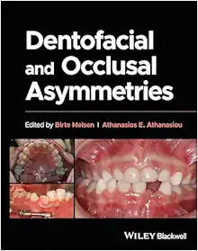 Dentofacial and Occlusal Asymmetries (Original PDF from Publisher)