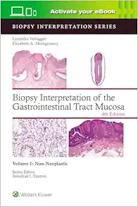 Biopsy Interpretation of the Gastrointestinal Tract Mucosa Volume 1: Non-Neoplastic, 4ed (EPUB + Converted PDF)