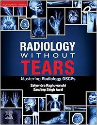 Radiology Without Tears: Mastering Radiology OSCEs (True PDF from Publisher)