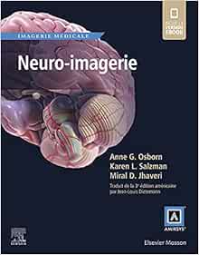 Neuro-imagerie - Collection Imagerie Médicale Amirsys - Osborn (Original PDF from Publisher)