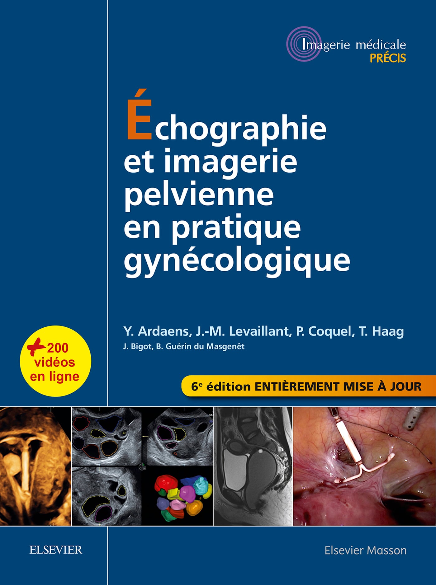 Échographie et imagerie pelvienne en pratique gynécologique, 6th Edition (Original PDF from Publisher)