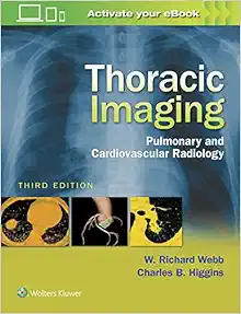 Thoracic Imaging: Pulmonary and Cardiovascular Radiology, 3rd edition (Original PDF from Publisher)
