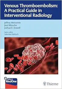Venous Thromboembolism: A Practical Guide in Interventional Radiology (EPUB)