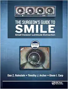The Surgeon's Guide to SMILE: Small Incision Lenticule Extraction (Videos)