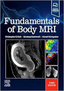 Fundamentals of Body MRI (Fundamentals of Radiology), 3rd edition (Original PDF from Publisher)