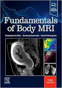 Fundamentals of Body MRI, 3rd edition (Fundamentals of Radiology) (True PDF)
