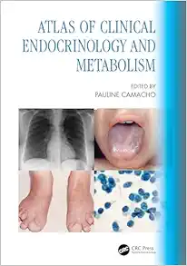 Atlas of Clinical Endocrinology and Metabolism (Original PDF from Publisher)