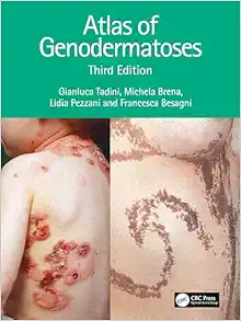 Atlas of Genodermatoses, 3rd Edition (Original PDF from Publisher)