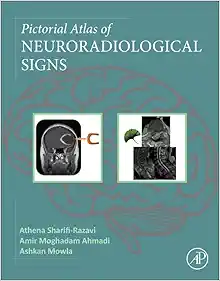 Pictorial Atlas of Neuroradiological Signs (Original PDF from Publisher)