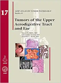 Tumors of the Upper Aerodigestive Tract and Ear (AFIP Atlas of Tumor Pathology, Series 4, Fascicle 17) (Original PDF from Publisher)