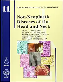 Non-Neoplastic Diseases of the Head and Neck (Atlas of Nontumor Pathology, Series 1, Number 11) (True PDF)