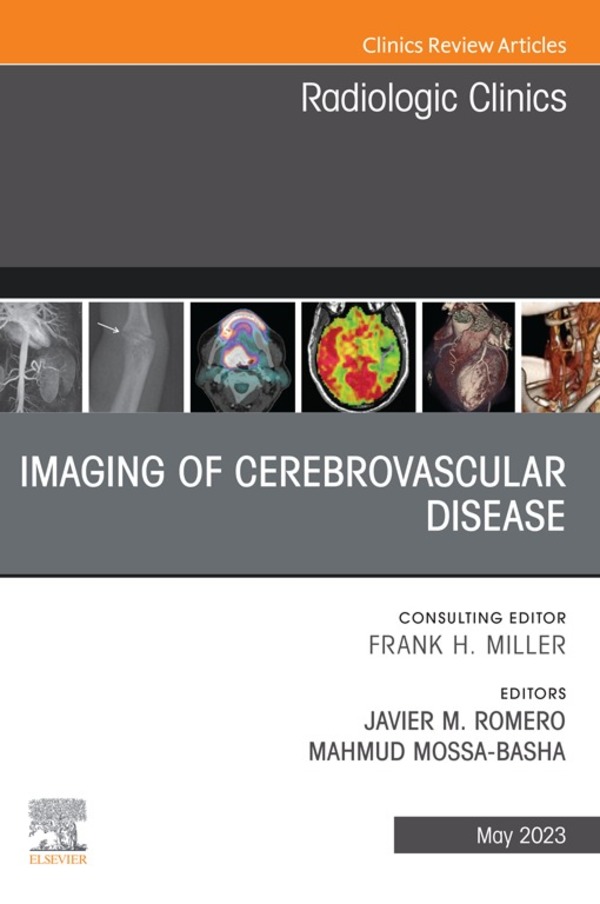 Imaging of Cerebrovascular Disease, An Issue of Radiologic Clinics of North America (Original PDF from Publisher)