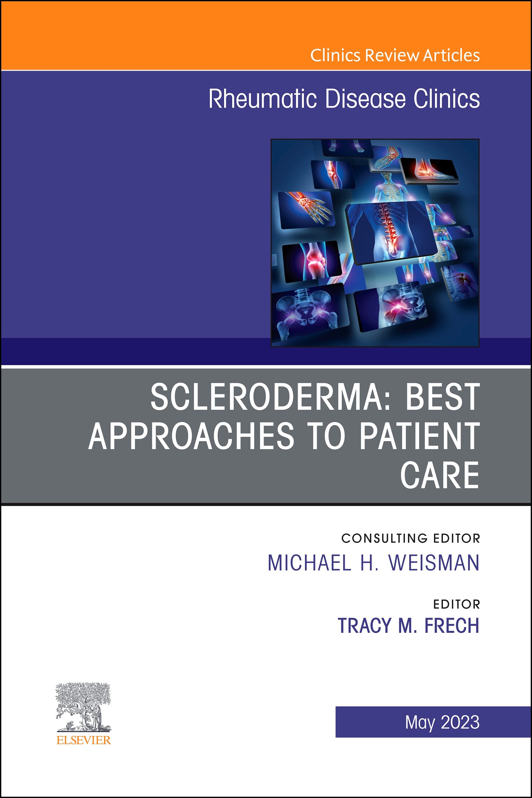 Scleroderma: Best Approaches to Patient Care, An Issue of Rheumatic Disease Clinics of North America (Original PDF from Publisher)
