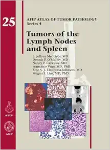 Tumors of the Lymph Nodes and Spleen (AFIP Atlas of Tumor Pathology, Series 4, Fascicle 25) (Original PDF from Publisher)