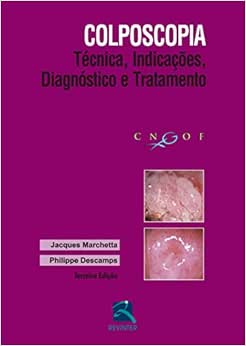 Colposcopia: Técnica, Indicações, Diagnóstico e Tratamento, 3rd Edition (Original PDF from Publisher)