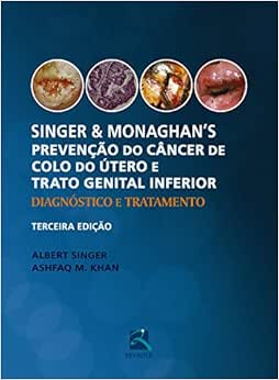 Singer e Monaghan's Prevenção do Câncer de Colo do Útero e Trato Genital Inferior: Diagnóstico e Tratamento, 3rd Edition (Original PDF from Publisher)