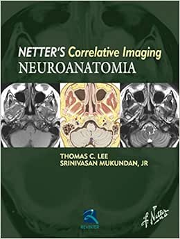 Neuroanatomia: Netter's Currelative Imaging, 1st Edition (Original PDF from Publisher)