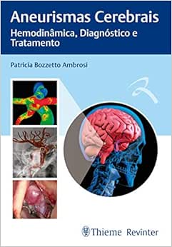 Aneurismas Cerebrais: Hemodinâmica, Diagnóstico e Tratamento, 1st Edition (Original PDF from Publisher)