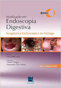 SOBED Atualização em Endoscopia Digestiva - Volume 2: Terapêutica Endoscópica no Esôfago - Ano 1, 1st Edition (EPUB)