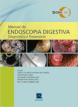 SOBED Manual de Endoscopia Digestiva: Diagnóstico e Tratamento, 1st Edition (Original PDF from Publisher)