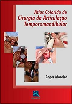 Atlas Colorido de Cirurgia da ATM, 1st Edition (EPUB)