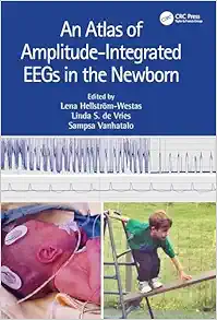 An Atlas of Amplitude-Integrated EEGs in the Newborn, 3rd edition (Original PDF from Publisher)