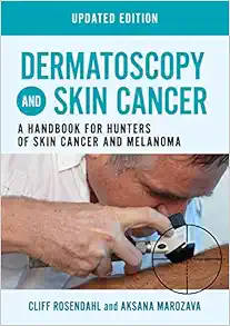 Dermatoscopy and Skin Cancer, updated edition: A handbook for hunters of skin cancer and melanoma (EPUB)