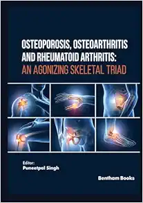 Osteoporosis, Osteoarthritis and Rheumatoid Arthritis: An Agonizing Skeletal Triad (EPUB)
