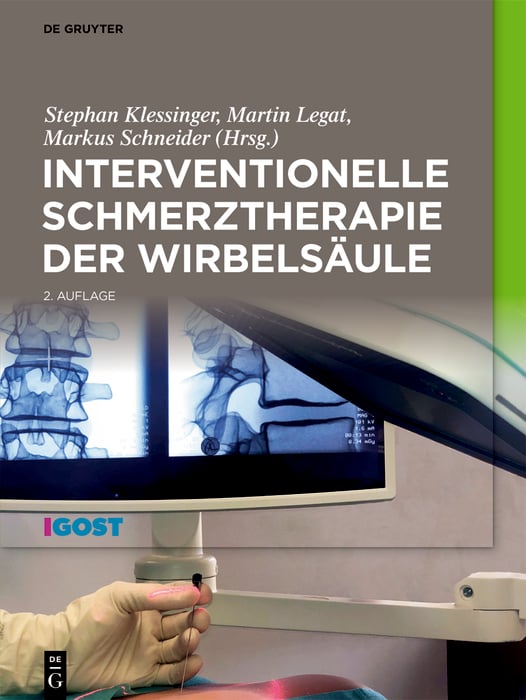 Interventionelle Schmerztherapie der Wirbelsäule (2nd ed.) (Original PDF from Publisher)