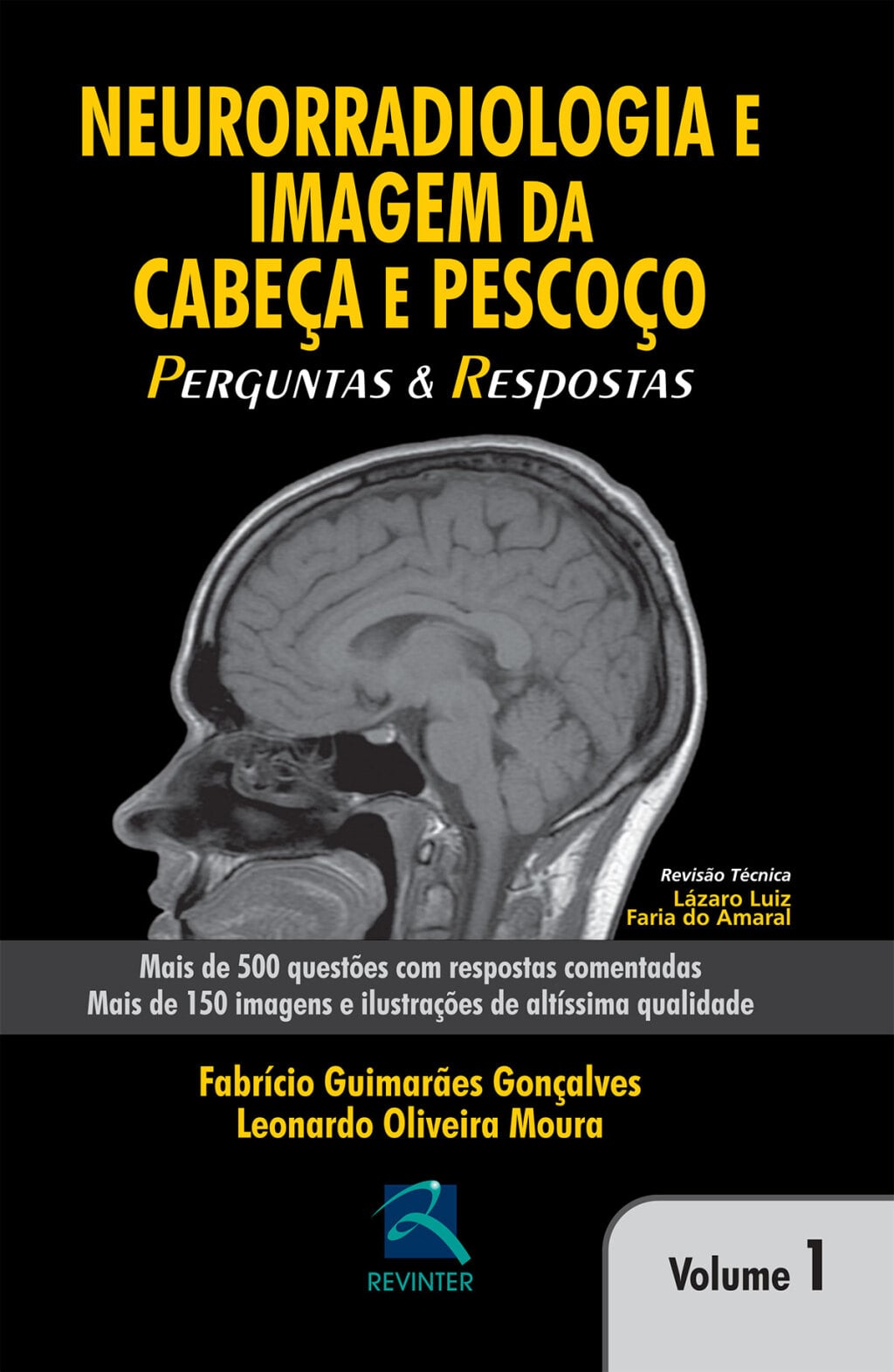 Neurorradiologia e Imagem da Cabeça e Pescoço : Perguntas e Respostas - Volume 1 (EPUB)