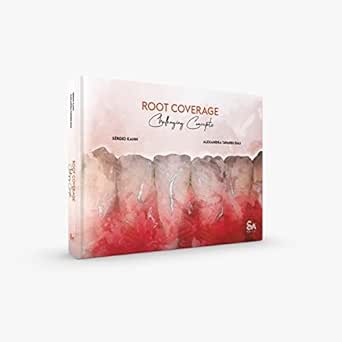 Root Coverage – Challenging Concepts (Original PDF from Publisher)