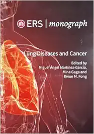 ERS Monograph 98 (Lung Diseases and Cancer) (EPUB)
