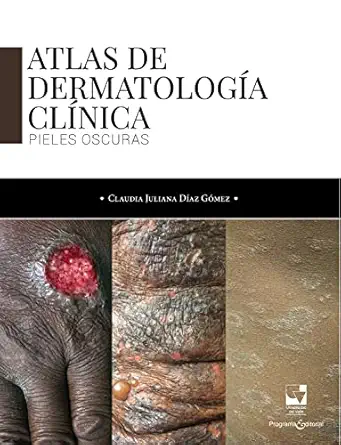 Atlas de dermatología clínica: Pieles oscuras (Salud) (Spanish Edition) (EPUB)