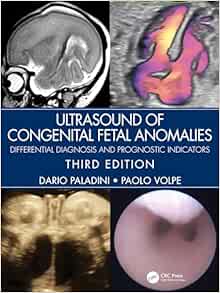 Ultrasound of Congenital Fetal Anomalies: Differential Diagnosis and Prognostic Indicators, 3rd Edition (EPUB)
