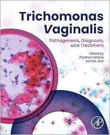Trichomonas vaginalis: Pathogenesis, Diagnosis, and Treatment (True PDF from Publisher)