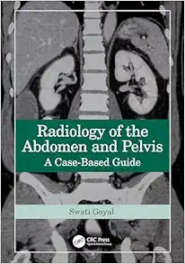 Radiology of the Abdomen and Pelvis: A Case-Based Guide (EPUB)